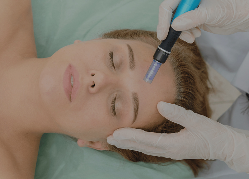 MICRONEEDLING